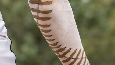 How Long Do Degradable Stitches Last?